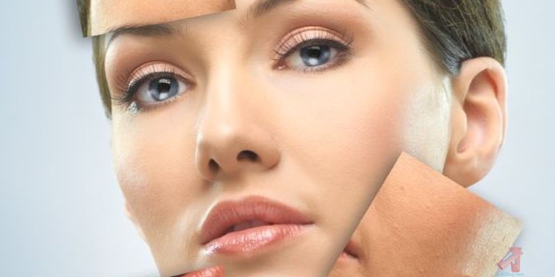 Treatments for Skin Peeling: The Phenomenon After Skin Peeling